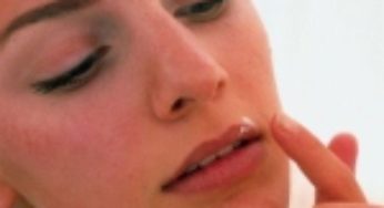 Impacco naturale per curare l’herpes!