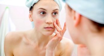 5 rimedi naturali contro borse e occhiaie, super efficaci!