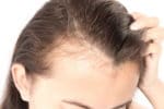 Fiale per capelli anticaduta e per capelli che si spezzano: ecco le migliori